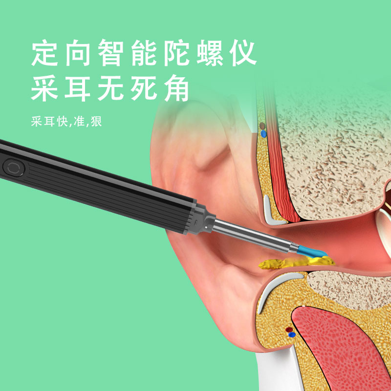 NE3.Pro智能可視采耳器