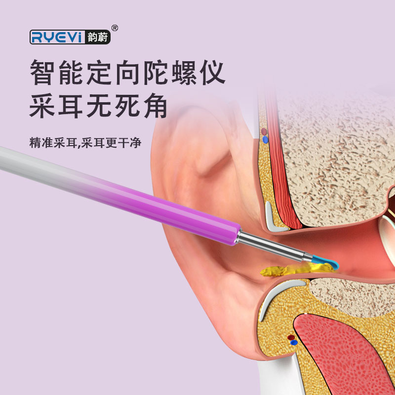 RV-007 智能可視采耳器